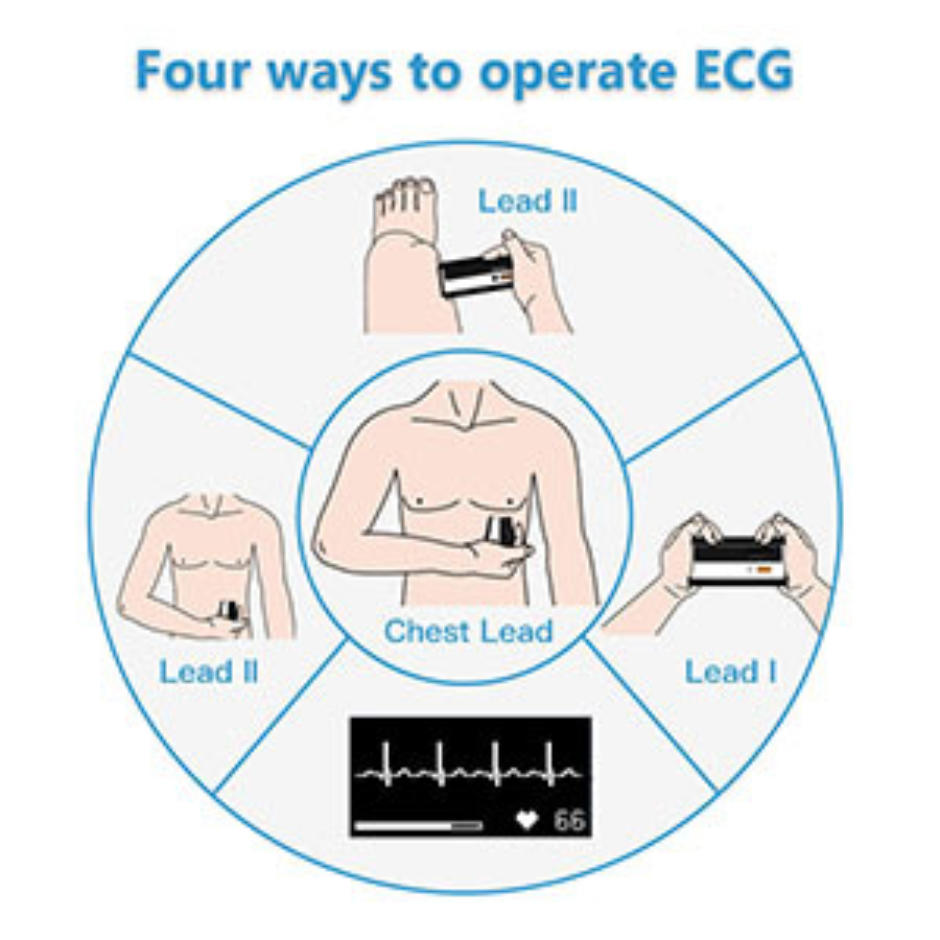 Diagram showing four ways to operate an ECG with labeled steps and illustrations.